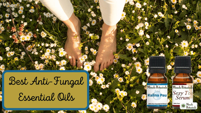 Bare feet among daisies beside Kalina Pau and Sexy Toe Serum oil bottles, with text: Best Anti-Fungal Essential Oils